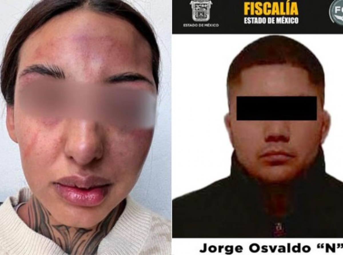 Detienen a sujeto que golpéo brutalmente a mujer 