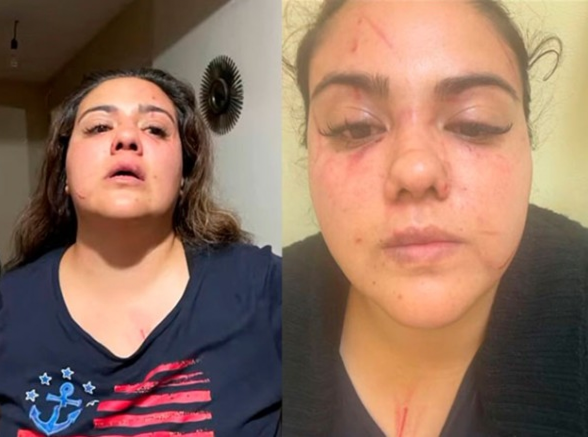 Denuncian agresión de exalcalde de Temascalcingo