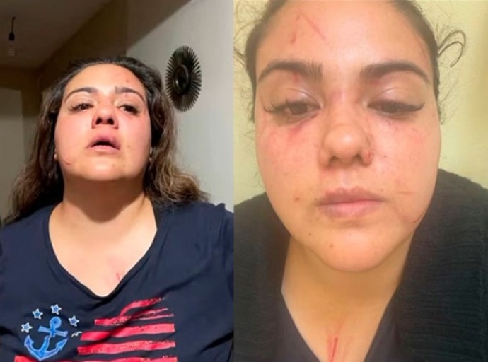 Denuncian agresión de exalcalde de Temascalcingo